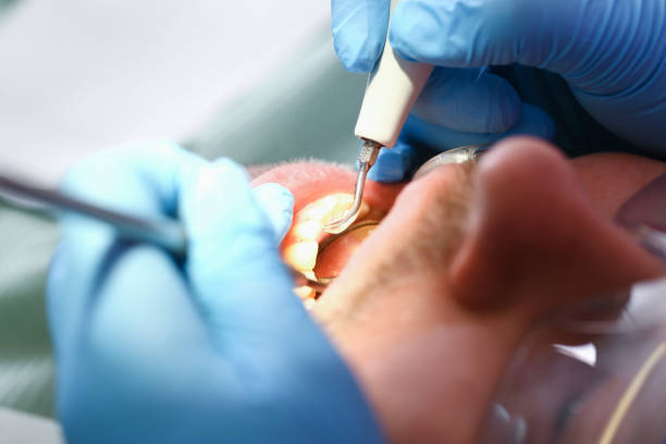 Best Emergency Tooth Extraction  in Marshall, VA