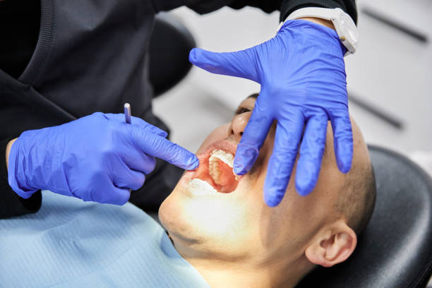 Best Chipped Tooth Repair Near Me  in Marshall, VA